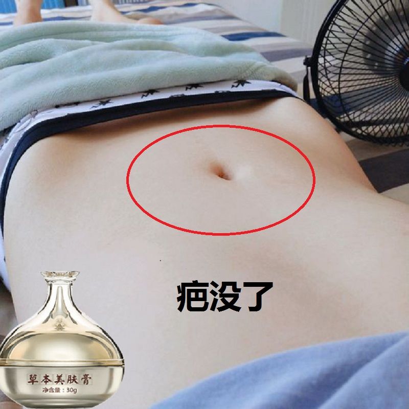 【小红书推荐】 疤疤无痕 默默无纹 68元一瓶 136元三瓶 拍2发3|msdalam kategori Penjagaan rambut/rambut palsu, perm rambut, krim rambut - dari Buy2taobao.com untuk memberikan perkhidmatan ejen Taobao profesional membeli