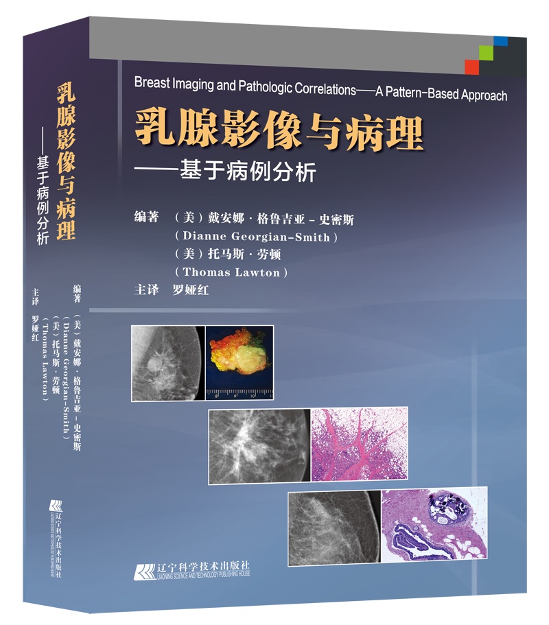 乳腺影像与病理对照图谱 基于病例的最优方法 乳腺影像诊断技术书籍 乳腺X线摄影或超声图像 临床影像科乳腺科医生实用工具书在类目 书籍/杂志/报纸, 医学卫生, 医学其它中 - 来自Buy2taobao.com提供专业的淘宝代购服务