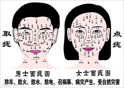 点痣膏去痣脸部无痕雀斑刺瘊猴子点斑黑点去除黑痣痦子正品祛痣膏