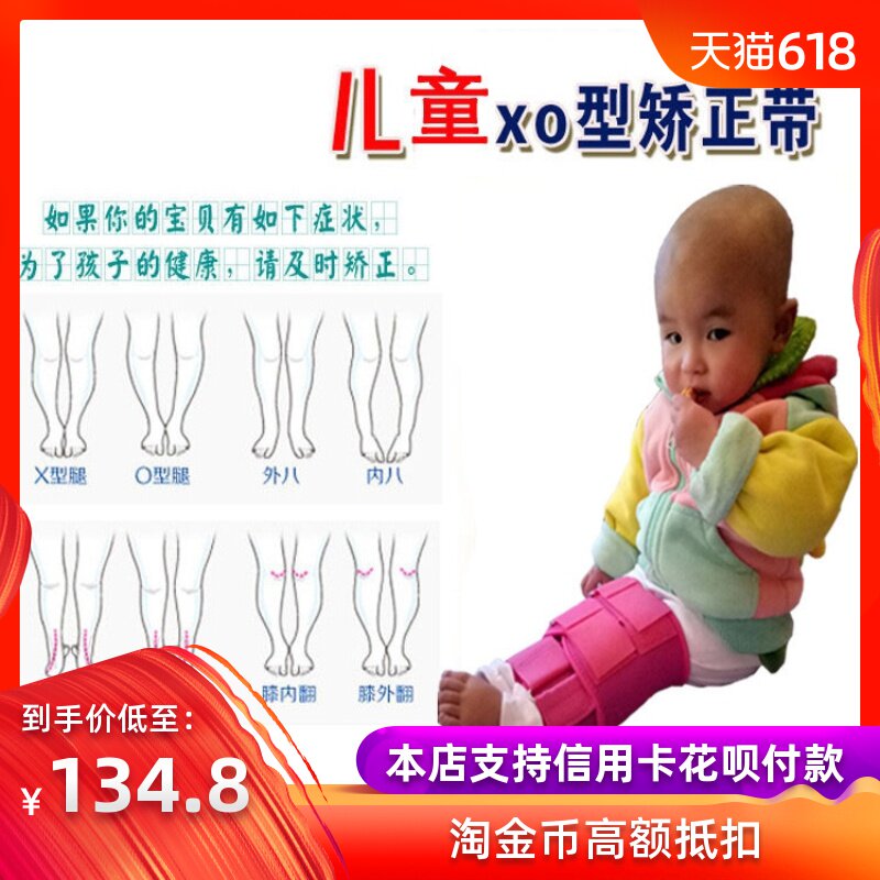 矫正器正畸纠正外八字婴儿腿型矫正器加强型定型小腿小孩子带矫正在类目 个人护理/保健/按摩器材, 美体瘦身, 矫姿用品中 - 来自Buy2taobao.com提供专业的淘宝代购服务