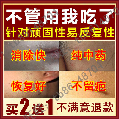 治疗扁平疣特效去除扁平疣面部无痛腐蚀中药四