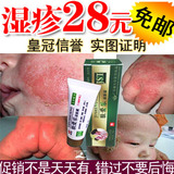 疹顺和安堂宝宝湿疹 无激素 皮炎奶癣 <em>尿布疹</em> 婴