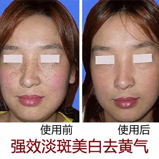 Take the tears of traditional Chinese medicine facial massage Detox to Huang Meibai buy 2 bottles get blemish anti aging eye cream 1 bottle