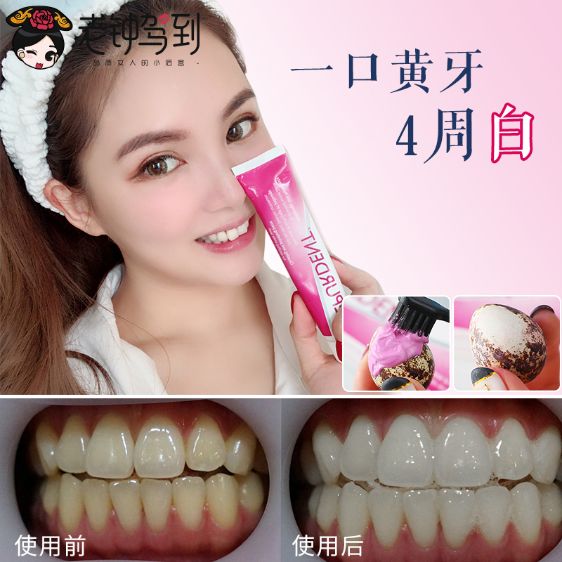 3天發4周去黃牙瑞士進口Dr.wild懷爾德牙膏去煙漬黃牙漬溫和潔在類目 洗護清潔劑/衛生巾/紙/香薰, 洗髮沐浴/個人清潔, 口腔護理, 牙膏中 - 來自Buy2taobao.com提供專業的淘寶代購服務