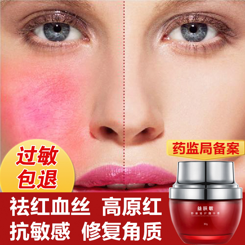 去除红血丝脸部皮肤过敏角质层修复霜抗敏感肌肤专用护肤品女正品在类目 美容护肤/美体/精油, 乳液/面霜中 - 来自Buy2taobao.com提供专业的淘宝代购服务