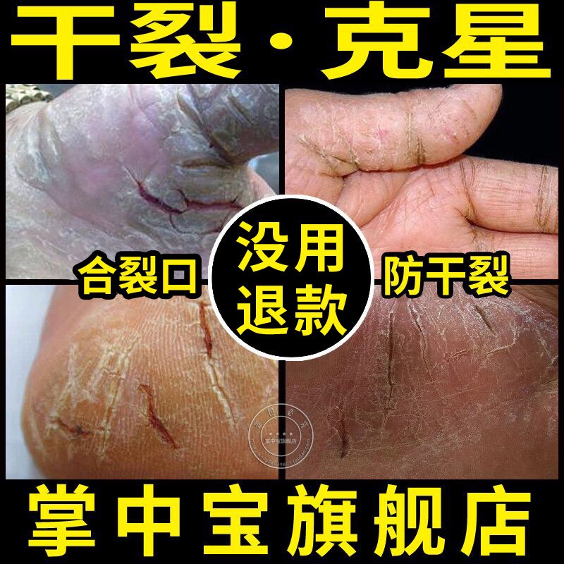 手列膏手足干裂霜正品防干裂护手霜手脚开裂脱皮防裂烈手油在类目 洗护清洁剂/卫生巾/纸/香薰, 洗发沐浴/个人清洁, 身体护理, 护手霜中 - 来自Buy2taobao.com提供专业的淘宝代购服务