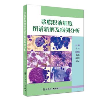 【SY】浆膜积液细胞图谱新解及病例分析 吴茅 9787117257176 人民在类目 书籍/杂志/报纸, 医学卫生, 医学其它中 - 来自Buy2taobao.com提供专业的淘宝代购服务