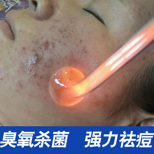 美容院祛痘美容仪器家用暗疮皮肤消炎杀菌粉刺皮肤红肿生发养发在类目 个人护理/保健/按摩器材, 清洁美容工具, 电子美容仪中 - 来自Buy2taobao.com提供专业的淘宝代购服务