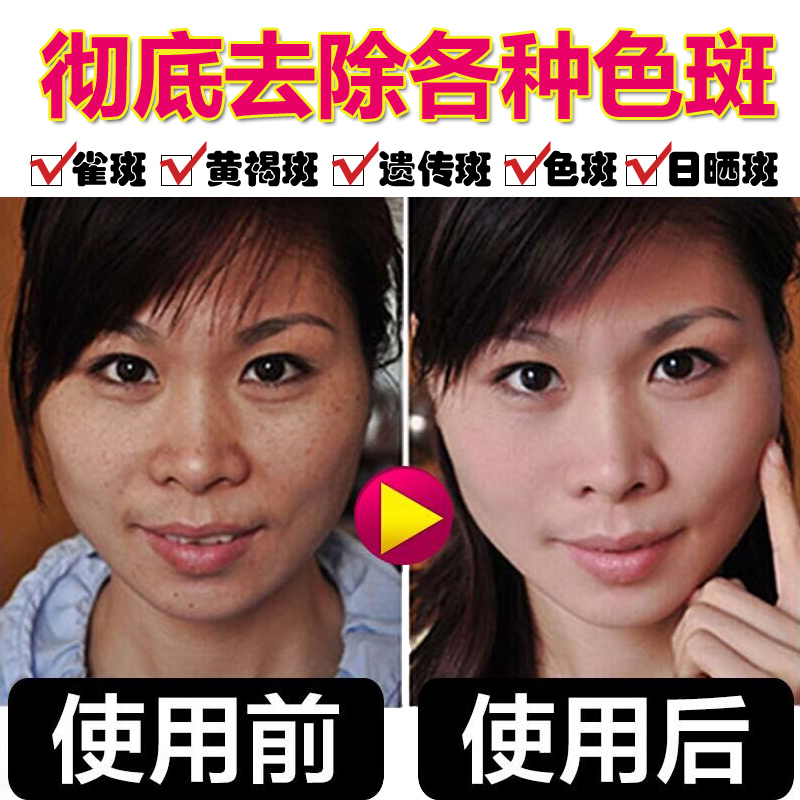 蜗牛祛斑洗面奶女男士补水保湿淡斑深层清洁美白去斑淡化色斑正品|ruв категории Средства для ухода за собой, моющее средство - от Buy2taobao.com для оказания профессиональной услуги покупки агента Taobao