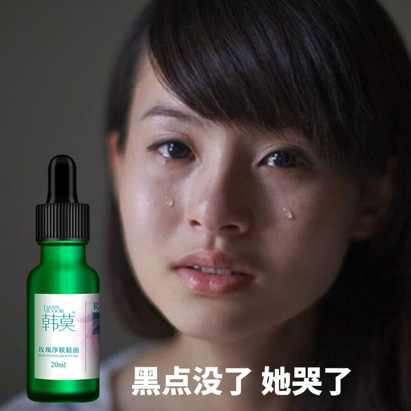 【买2送1】去黑点神器 恢复净颜亮肤 玫瑰净颜精油 男女通用|ruв категории Средства для ухода за собой, эфирные масла Ароматерапия, эфирное масло - от Buy2taobao.com для оказания профессиональной услуги покупки агента Taobao