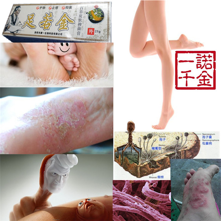 手足癬藥膏季節性脫皮角化增厚型鵝掌風鱗屑病多出汗疱疹水泡脫落在類目 本地化生活服務, 健康服務, 足浴/洗浴/按摩中 - 來自Buy2taobao.com提供專業的淘寶代購服務