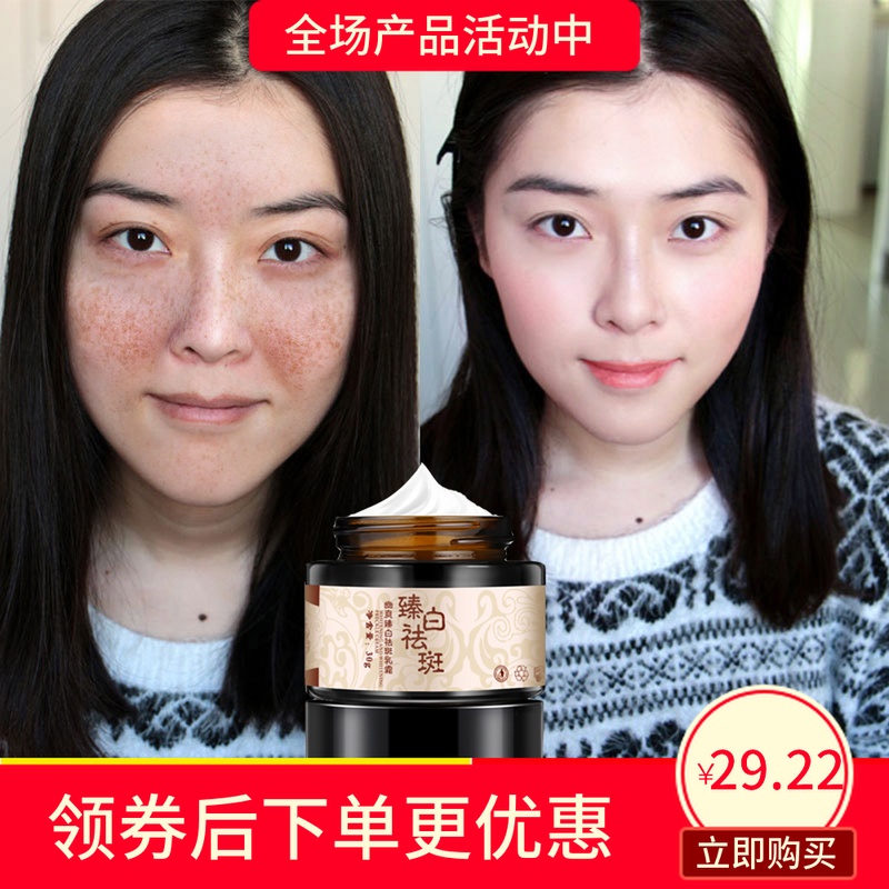 men and women currency skin whitening Freckle cream quality goods Moisture Desalination Stain Chloasma Sunburn Pregnancy spots Melanin Face creamin the Care cleaners/Sanitary napkins/Paper/Aromatherapy , Shampoo bath/Personal cleanliness , Facial Cleansing/Nurse , Emulsion/Cream category - from Buy2taobao.com to provide professional Taobao agent buy service