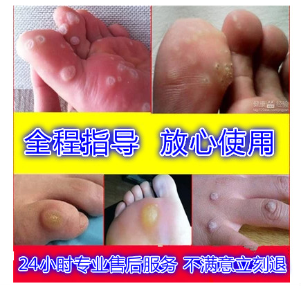 Zhou Filamentous Calluses door mat Scales Fish Sue currencyin the Care cleaners/Sanitary napkins/Paper/Aromatherapy , Shampoo bath/Personal cleanliness , Body Care , Hand Cream category - from Buy2taobao.com to provide professional Taobao agent buy service