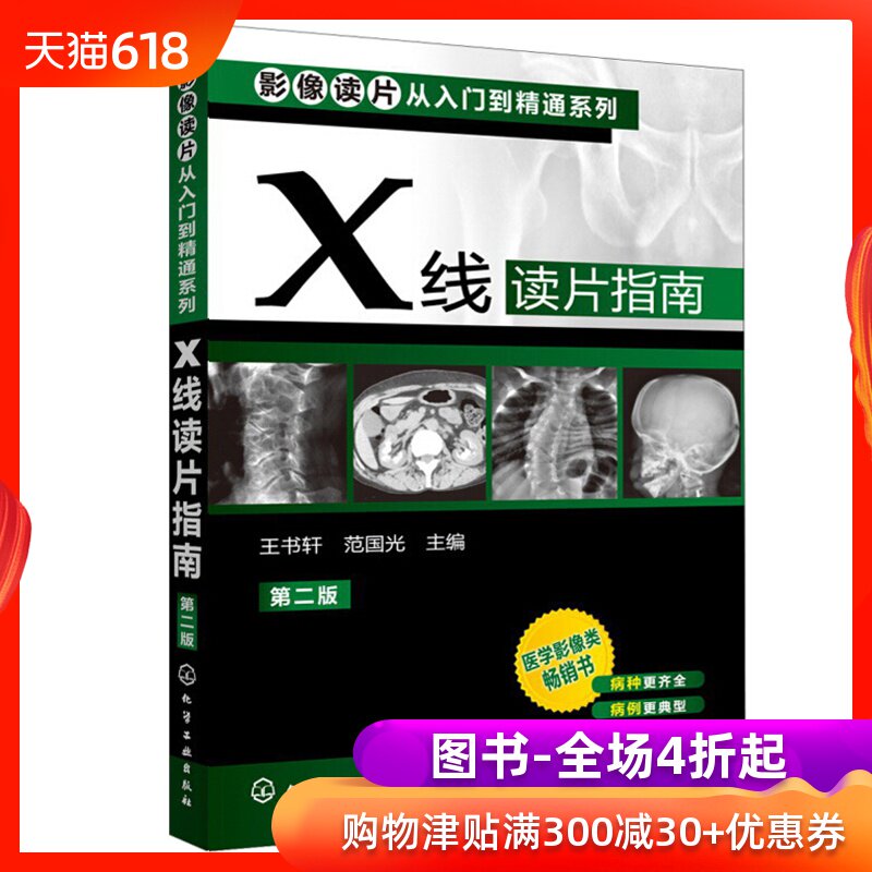 影像读片从入门到精通系列X线读片指南 第二版 医学影像学类书 常见病影像临床医学教程教材书籍 诊断学基层医师医生参考图书籍|msdalam kategori buku/Magazine/akhbar, Kesihatan perubatan, ubat lain - dari Buy2taobao.com untuk memberikan perkhidmatan ejen Taobao profesional membeli
