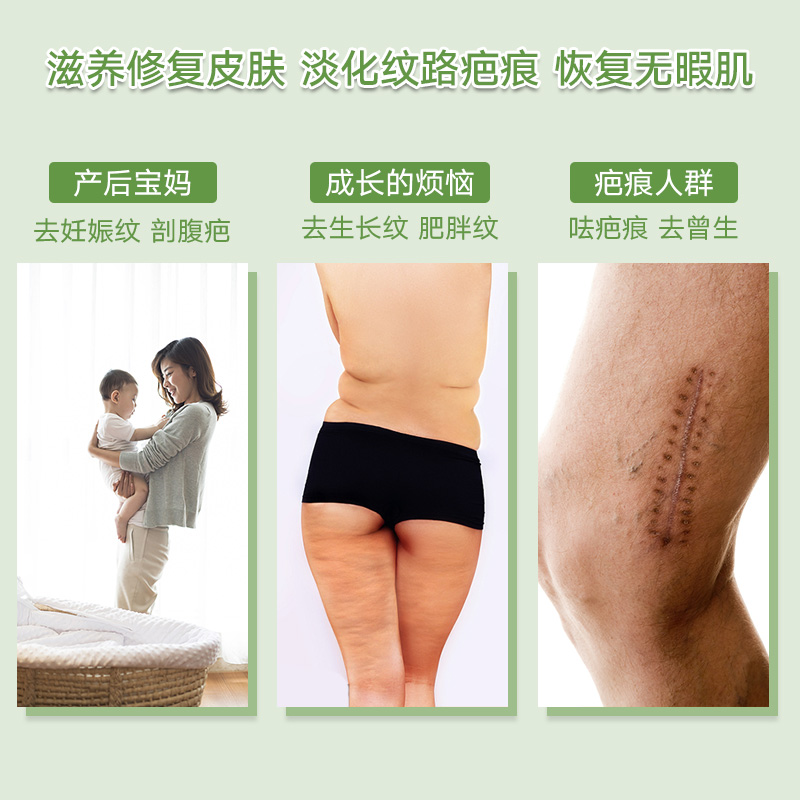 期装】薰衣草修痕平纹创微秀痕萍文霜[3盒周霜中科院非遗官网正品|msdalam kategori rumah harian, Peralatan perlindungan, kneepad/tali pinggang/bahu/perlindungan leher - dari Buy2taobao.com untuk memberikan perkhidmatan ejen Taobao profesional membeli