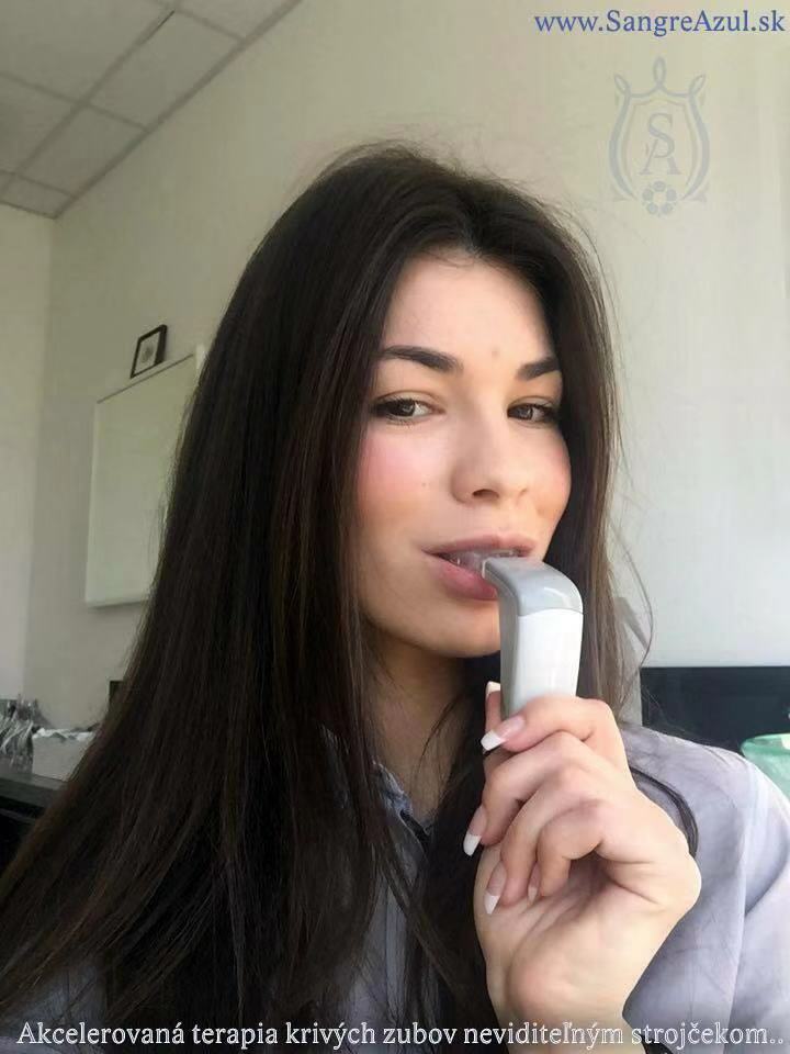 正畸加速器 隱適美 鋼絲 時代天使 美國牙套加速器隱適美加速器整在類目 個人護理/保健/按摩器材, 清潔美容工具, 電子美容儀中 - 來自Buy2taobao.com提供專業的淘寶代購服務