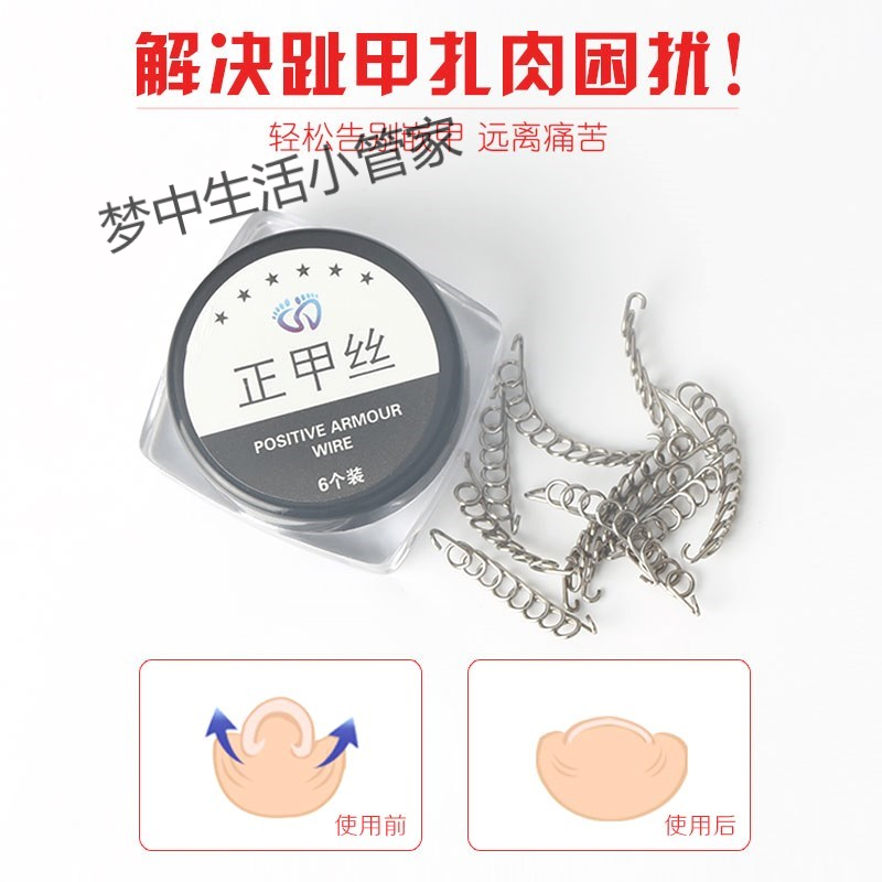 正貼片腳趾甲矯正器腳指甲長肉裏絲嵌甲貼校正器炎腳溝甲溝矯在類目 家庭/個人清潔工具, 個人洗護清潔用具, 指甲刀/指甲鉗, 其它中 - 來自Buy2taobao.com提供專業的淘寶代購服務