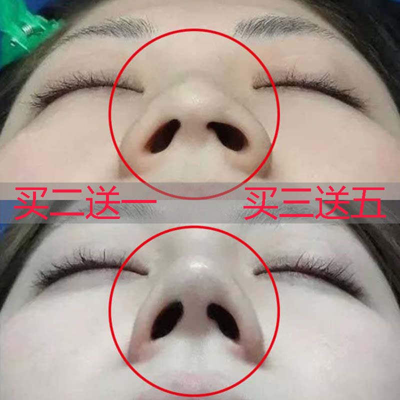 【抖音同款 买2送1】告别丑鼻子 美鼻神器 挺出你的新高度|msdalam kategori Beauty/badan/minyak pati, minyak pati aromaterapi, Minyak Essential - dari Buy2taobao.com untuk memberikan perkhidmatan ejen Taobao profesional membeli