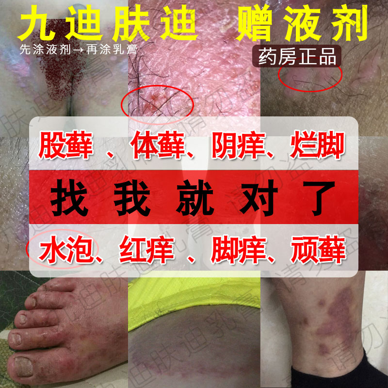 正品九迪膚迪草本膏善抑菌液劑葉止癢千金方外用藥高乳膏皮膚成人在類目 洗護清潔劑/衛生巾/紙/香薰, 洗髮沐浴/個人清潔, 身體護理, 其它身體護理產品中 - 來自Buy2taobao.com提供專業的淘寶代購服務