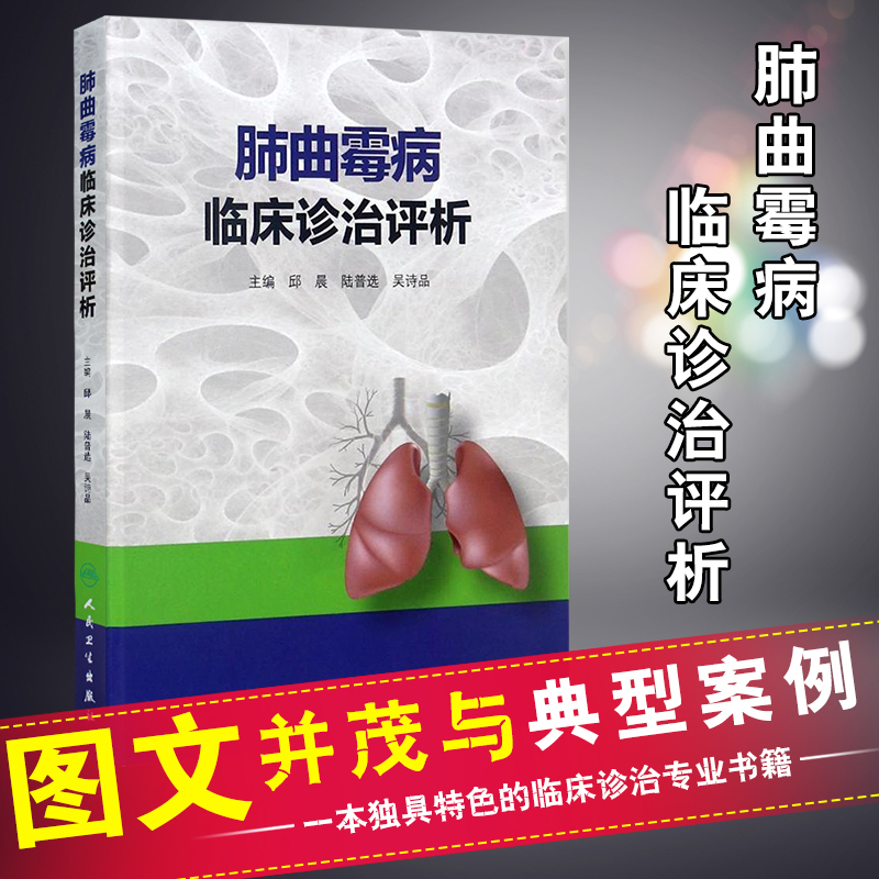 正版包邮 肺曲霉病临床诊治评析 人民卫生出版社 主编 邱晨 陆普选 吴诗品|msdalam kategori buku/Magazine/akhbar, Kesihatan perubatan, Perubatan klinikal - dari Buy2taobao.com untuk memberikan perkhidmatan ejen Taobao profesional membeli