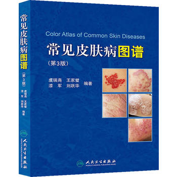 full 88 Send bookmarks Thinker common Skin disease atlas One Wait 9787117170161in the Books/Magazine/Newspaper , Medical Health , Medical Other category - from Buy2taobao.com to provide professional Taobao agent buy service