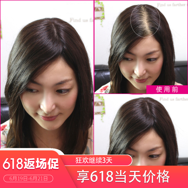 女士 真人发织发补发 递针工艺真发织发补发片 头顶补发块 假发片|msdalam kategori Penjagaan rambut/rambut palsu, rambut palsu, lembaran lurus - dari Buy2taobao.com untuk memberikan perkhidmatan ejen Taobao profesional membeli