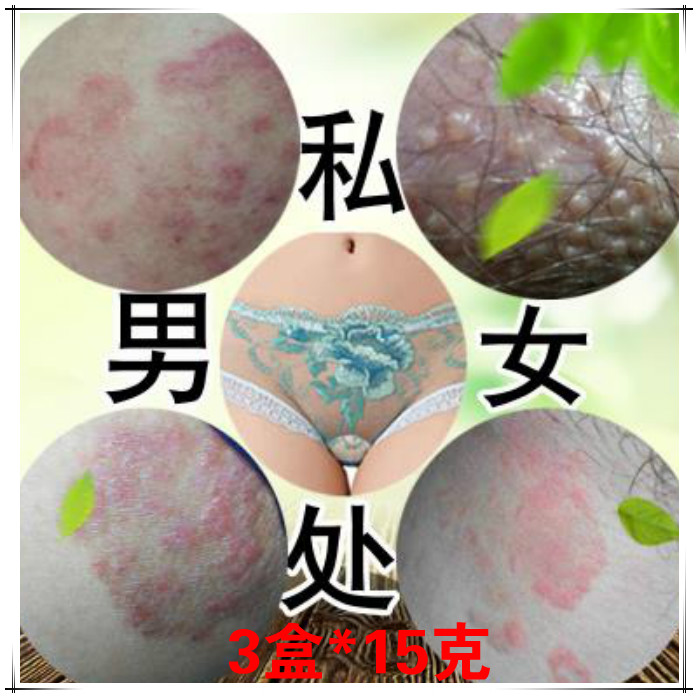 3盒苯海拉名明乳軟膏薄荷霜私處大腿根外陰肛周屁眼私陰癢霜膏靈在類目 洗護清潔劑/衛生巾/紙/香薰, 洗髮沐浴/個人清潔, 身體護理, 其它身體護理產品中 - 來自Buy2taobao.com提供專業的淘寶代購服務