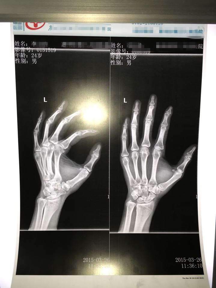 瓷白喷墨激光两用 A3放射打印胶片 X光胶片CR DR CT胶片 180厚在类目 办公设备/耗材/相关服务, 办公用纸, 相片纸中 - 来自Buy2taobao.com提供专业的淘宝代购服务