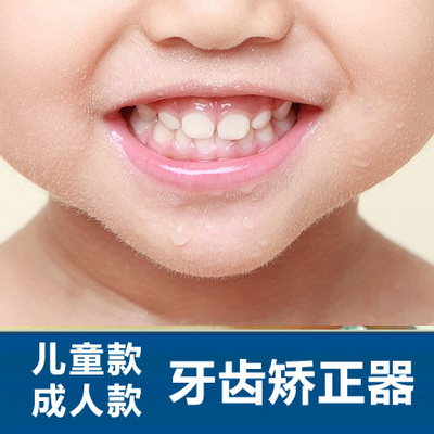 磨牙牙套成人牙齿矫正器 儿童正畸矫正地包天牙齿不齐突出深覆合