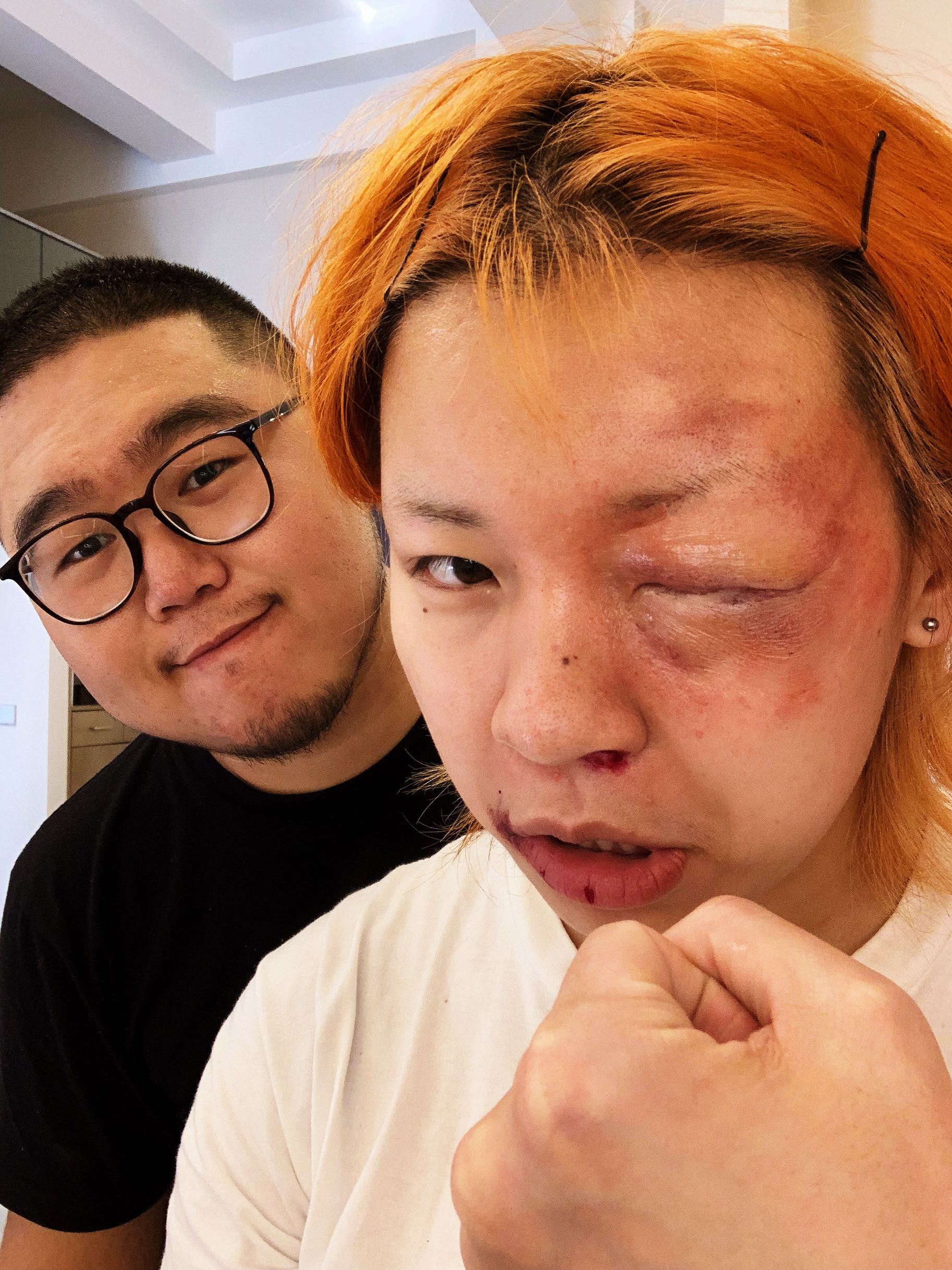 腫眼假皮 老鼠鼻子假皮 鉑金矽膠可溶邊 超自然在類目 模玩/動漫/周邊/cos/桌遊, Cosplay服飾/道具/服務, cos攝影/後期/化妝中 - 來自Buy2taobao.com提供專業的淘寶代購服務