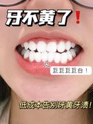 牙齿美白 速效 黄牙去黄牙齿神器牙白牙黄美白洗牙齿污垢除牙石洗