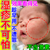 紫草膏婴儿专用湿疹宝宝尿布疹口水疹红屁股热疹蚊虫叮咬止痒消肿