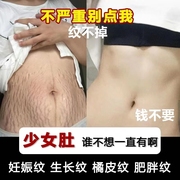 去妊娠纹修复霜橄榄油孕妇，产后修护淡化消除男女士，肥胖生长纹紧致