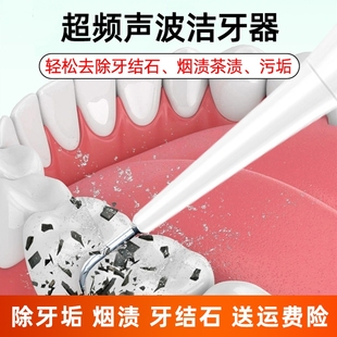 超声波洁牙器牙结石牙垢去除器，牙齿美白洗牙神器美牙仪口腔镜清除
