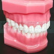 牙科牙模型28颗标准，红色牙模型展示教学医患沟通牙齿模型齿科
