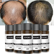 efero 头发增长液育发液密发生长精华素加快变长固发强根防掉发