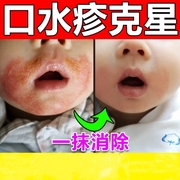 口水疹膏婴儿宝宝专用预防初宝唇周口水修护神器，冬季润本面霜药膏