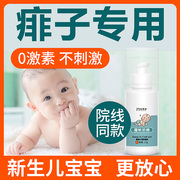 宝宝痱子膏去痱止痒痱子，粉新生儿婴儿专用热痱子霜儿童痱子水祛痱