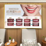 美牙广告图口腔美容装饰画牙贴面挂画牙齿美白图片瓷贴面宣传海报