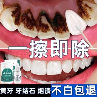 洗牙粉去黄洗白去口臭美白速效，黄牙洗牙齿，污垢除牙石烟渍牙垢神器