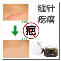 去脸部伤疤痕停的药祛巴印淡化黑色素沉淀舒疤宁平面膜修复膏