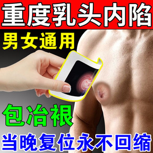 乳头内陷矫正器乳头牵引器男士少女凹陷拔奶头大吸力男性发育不良