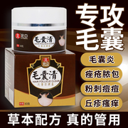 天赋老中医草本乳膏皮肤瘙痒止痒膏私处护理老中翳抑菌软膏