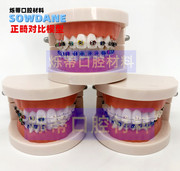 牙科牙模型正畸模型白色，标准3种对比模型，金属陶瓷齿科医患沟通