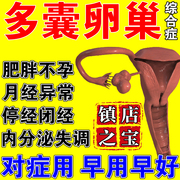 多囊卵巢综合征调理月经不调子宫内膜调理增厚促排卵助备孕泡脚包