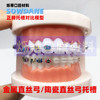 牙科牙模型白色标准，2种对比模型金属陶瓷齿科医患沟通讲解