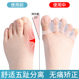 脚趾矫正器大脚趾拇指外翻纠正神器脚趾重叠分趾器男女士可以穿鞋