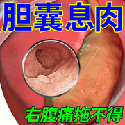 胆囊息肉治胆囊多发性胆息肉腹痛胆结石溶石化石胆囊炎中药贴