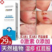湿疹婴儿专用宝宝湿疹膏身体乳干性保湿霜口水疹儿童红屁股脸上