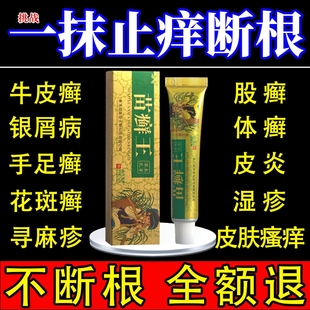 苗癣王草本乳膏皮癣药膏外用杀菌皮肤湿疹止痒去根苗医药膏